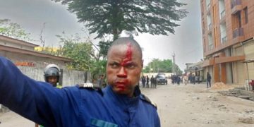 Troubles à l&rsquo;Institut Supérieur des Techniques Appliquées : 9 policiers blessés dont 5 sont dans un état critique (bilan officiel)