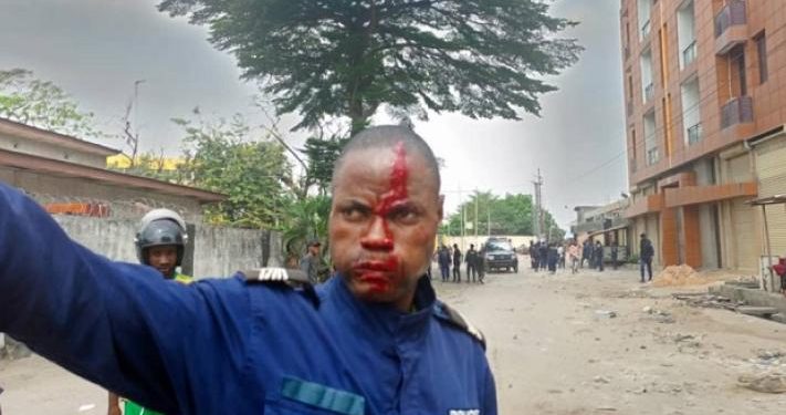 Troubles à l’Institut Supérieur des Techniques Appliquées : 9 policiers blessés dont 5 sont dans un état critique (bilan officiel)