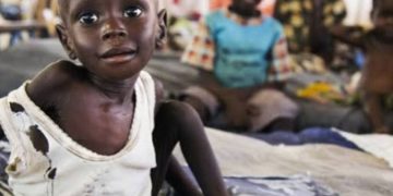 Crise humanitaire : La RDC a atteint les niveaux record de la faim (Nations Unies)