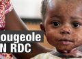 RDC: 5.799 décès enregistrés de la rougeole depuis 2023 (ministère de la santé publique)