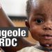 RDC: 5.799 décès enregistrés de la rougeole depuis 2023 (ministère de la santé publique)