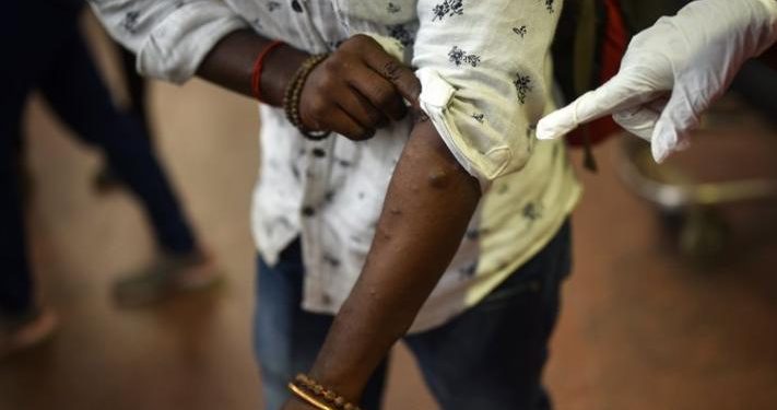 RDC : 1134 cas supplémentaires de Monkey enregistrés depuis le début de l’année 2024