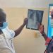 Santé: En 2023, la RDC a enregistré plus de 260 mille cas de tuberculose (ministère de la santé)