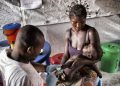 Haut-Uele : 144 cas de rougeole dont 2 décès enregistrés dans la zone de santé de Doruma (Officiel)
