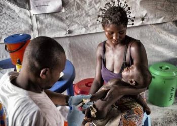 Haut-Uele : 144 cas de rougeole dont 2 décès enregistrés dans la zone de santé de Doruma (Officiel)