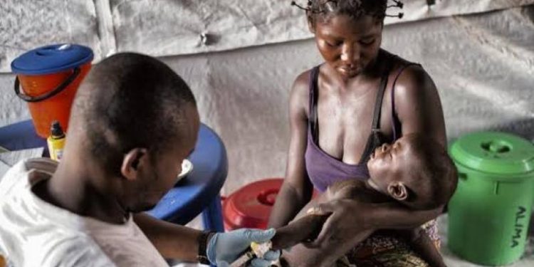 Haut-Uele : 144 cas de rougeole dont 2 décès enregistrés dans la zone de santé de Doruma (Officiel)