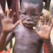 Variole du singe : La RDC a enregistré 11.166 cas suspects de cette maladie dont 450 décès, soit une létalité de 4% (Le ministère de la santé)