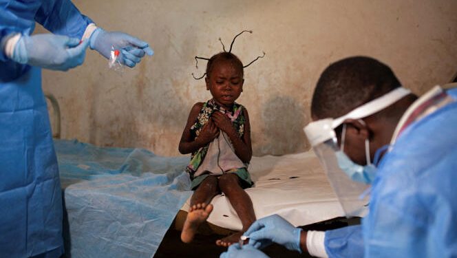 Variole du singe : Les Etats-Unis débloquent 35 millions USD pour la riposte africaine (Document)