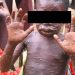 RDC : La province du Sud-Kivu a enregistré plus de 14.500 cas de l’épidémie de MONKEYPOX depuis janvier 2024 (Ministère de santé)
