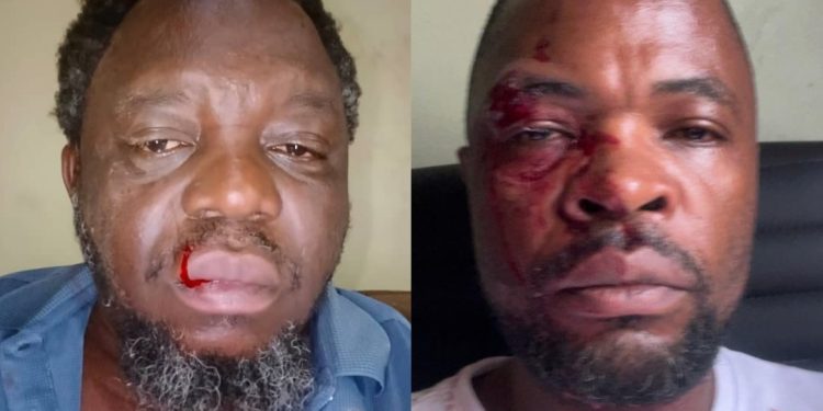 Crise à l’assemblée provinciale de Lomami : bagarre sanglante entre le Vice Président et le rapporteur