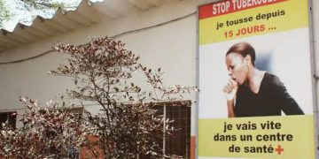 Kongo-Central: Plus de 373 patients atteints de tuberculose pharmaco-resistante enregistrés depuis le début de l&rsquo;année 2025