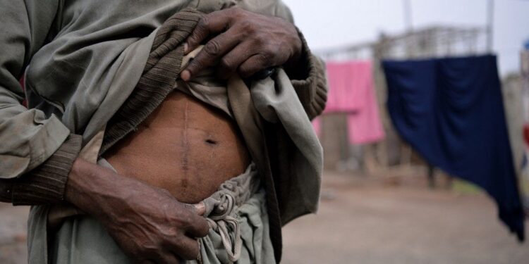 Prétendu vol d’organes génitaux à Lubumbashi et Kolwezi : désillusion, rumeurs, mythe ou réalité ?