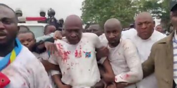 Sit-in de l&rsquo;opposition : Répression sanglante de force de l&rsquo;ordre, Martin Fayulu et plusieurs militants blessés