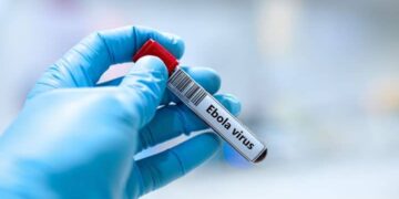 RDC : Deux vaccins contre Ebola-Bundibyo entrent en essais cliniques, l’OMS appelle à renforcer la riposte